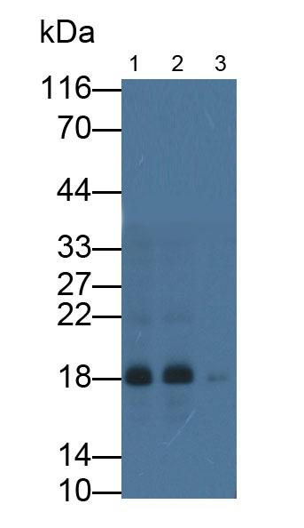 Monoclonal Antibody to Acid Phosphatase 1 (ACP1)