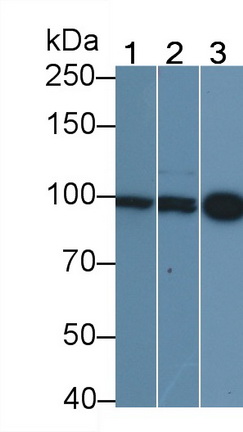 Monoclonal Antibody to Beta Catenin (β-catenin)