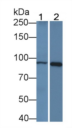 Monoclonal Antibody to Beta Catenin (β-catenin)