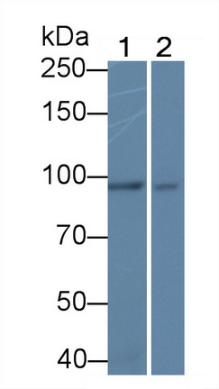 Monoclonal Antibody to Beta Catenin (β-catenin)