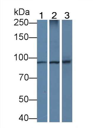 Monoclonal Antibody to Beta Catenin (β-catenin)