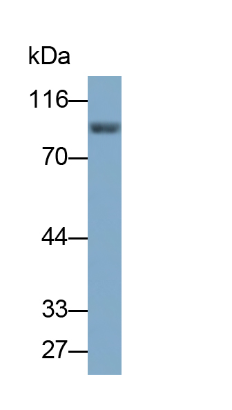 Monoclonal Antibody to Beta Catenin (β-catenin)