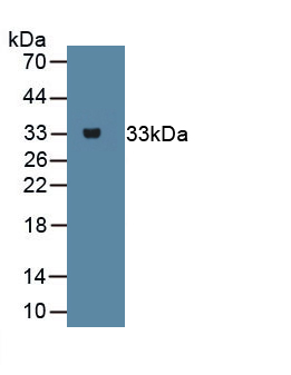 Monoclonal Antibody to Beta Catenin (β-catenin)