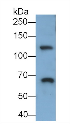 Monoclonal Antibody to Integrin Alpha 2B (ITGa2B)