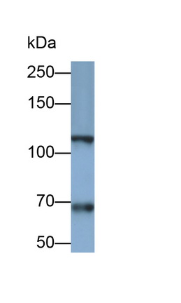 Monoclonal Antibody to Integrin Alpha 2B (ITGa2B)