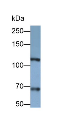 Monoclonal Antibody to Integrin Alpha 2B (ITGa2B)