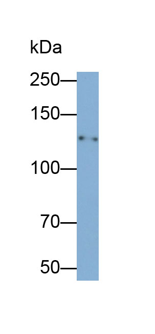 Monoclonal Antibody to Integrin Alpha 2B (ITGa2B)