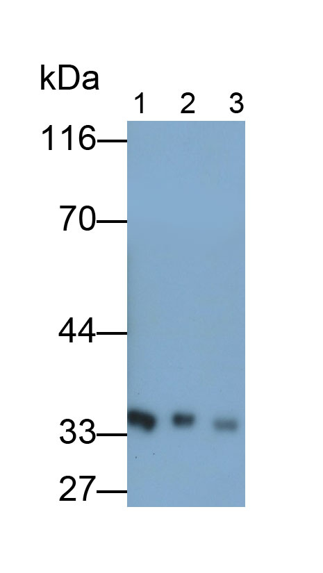 Monoclonal Antibody to Growth Hormone Receptor (GHR)