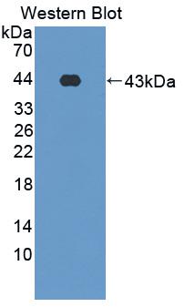 Monoclonal Antibody to Surfactant Associated Protein D (SPD)