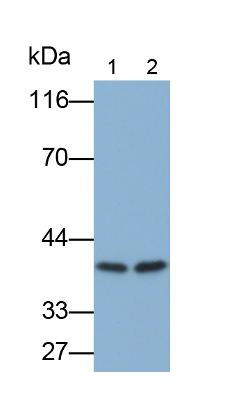 Monoclonal Antibody to Surfactant Associated Protein D (SPD)