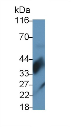 Monoclonal Antibody to Surfactant Associated Protein D (SPD)