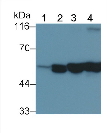 Monoclonal Antibody to Vimentin (VIM)