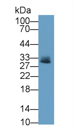 Monoclonal Antibody to Tryptase (TPS)