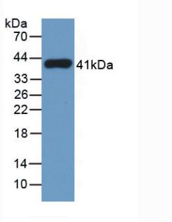 Monoclonal Antibody to Tryptase (TPS)