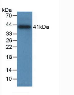 Monoclonal Antibody to Tryptase (TPS)