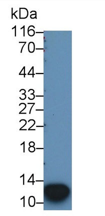 Monoclonal Antibody to S100 Calcium Binding Protein A12 (S100A12)