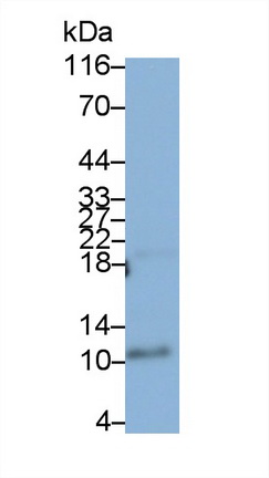 Monoclonal Antibody to S100 Calcium Binding Protein A12 (S100A12)