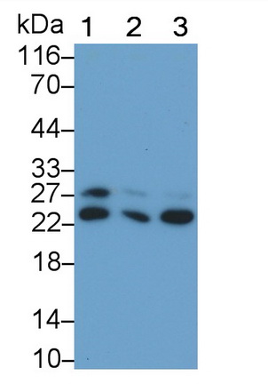 Monoclonal Antibody to Glutathione S Transferase Pi (GSTp)