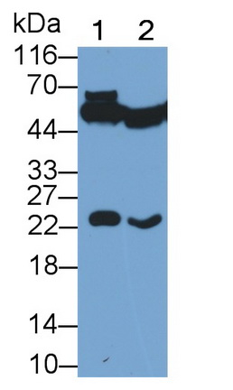 Monoclonal Antibody to Glutathione S Transferase Pi (GSTp)