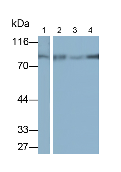 Monoclonal Antibody to Alkaline Phosphatase, Tissue-nonspecific (ALPL)