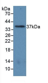 Monoclonal Antibody to Arginase (ARG)