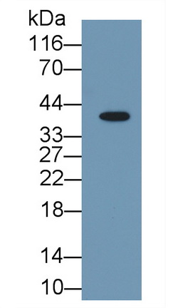 Monoclonal Antibody to Arginase (ARG)