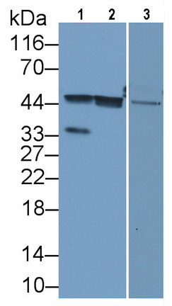 Monoclonal Antibody to Arginase (ARG)