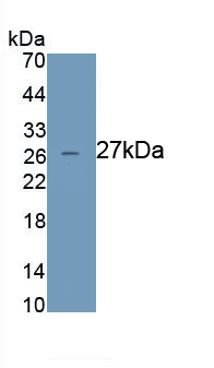 Monoclonal Antibody to Sialic Acid Binding Ig Like Lectin 2 (CD22)