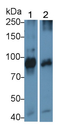 Monoclonal Antibody to Transferrin Receptor (TFR)