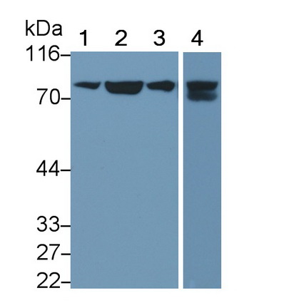 MAB171Hu25.jpg