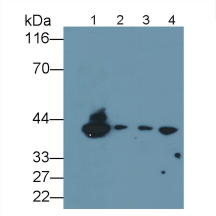 Monoclonal Antibody to Cluster Of Differentiation 1a (CD1a)