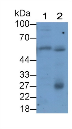 Monoclonal Antibody to Glucose Transporter 1 (GLUT1)