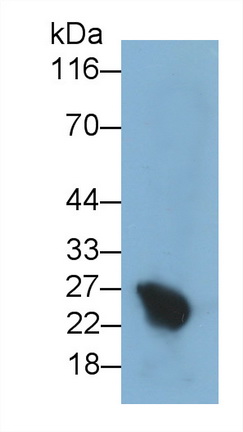 Monoclonal Antibody to Placental Lactogen (PL)