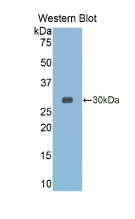 Monoclonal Antibody to Granzyme K (GZMK)