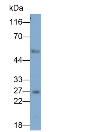 Monoclonal Antibody to Granzyme K (GZMK)