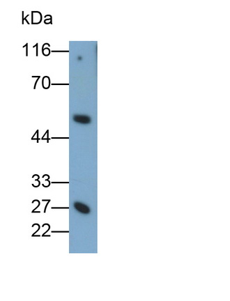 Monoclonal Antibody to Granzyme K (GZMK)