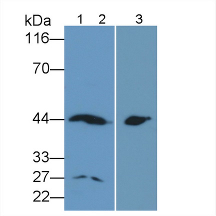 Monoclonal Antibody to Aspartate Aminotransferase (AST)