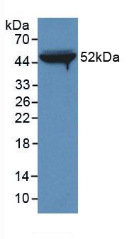 Monoclonal Antibody to Fibrinogen Beta Chain (FGB)