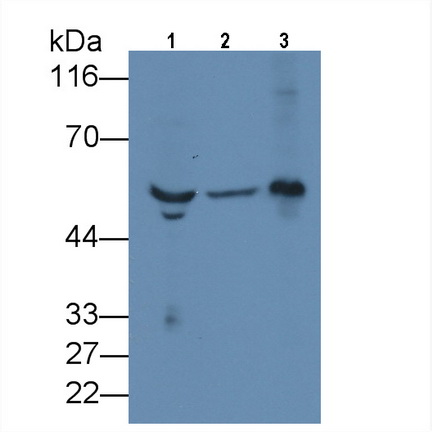 Monoclonal Antibody to Fibrinogen Beta Chain (FGB)