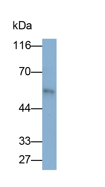 Monoclonal Antibody to Fibrinogen Beta Chain (FGB)