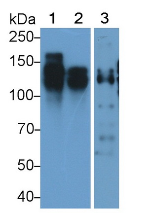 Monoclonal Antibody to Cluster Of Differentiation 56 (CD56)