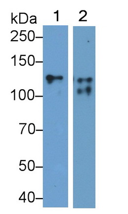 Monoclonal Antibody to Cluster Of Differentiation 56 (CD56)