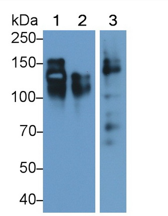 Monoclonal Antibody to Cluster Of Differentiation 56 (CD56)