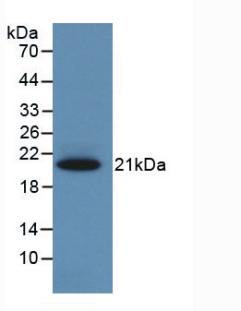 Monoclonal Antibody to Corticosteroid Binding Globulin (CBG)