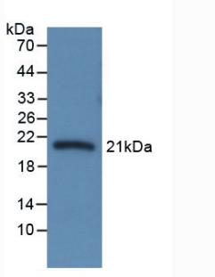 Monoclonal Antibody to Corticosteroid Binding Globulin (CBG)