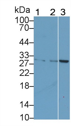 Monoclonal Antibody to Cytotoxic T-Lymphocyte Associated Antigen 4 (CTLA4)