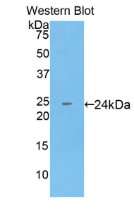 Monoclonal Antibody to Cytokeratin 18 (CK18)