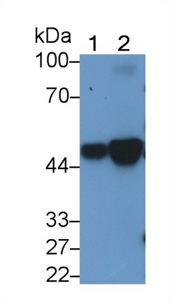 Monoclonal Antibody to Cytokeratin 18 (CK18)