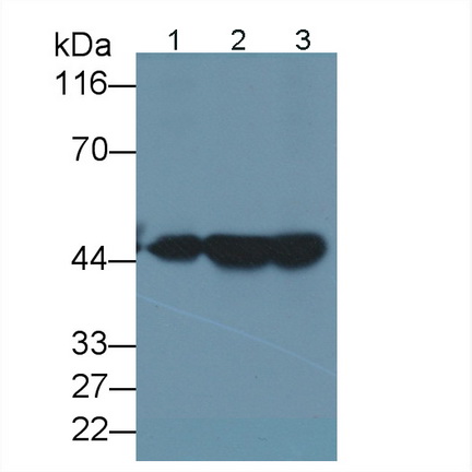 Monoclonal Antibody to Cytokeratin 18 (CK18)