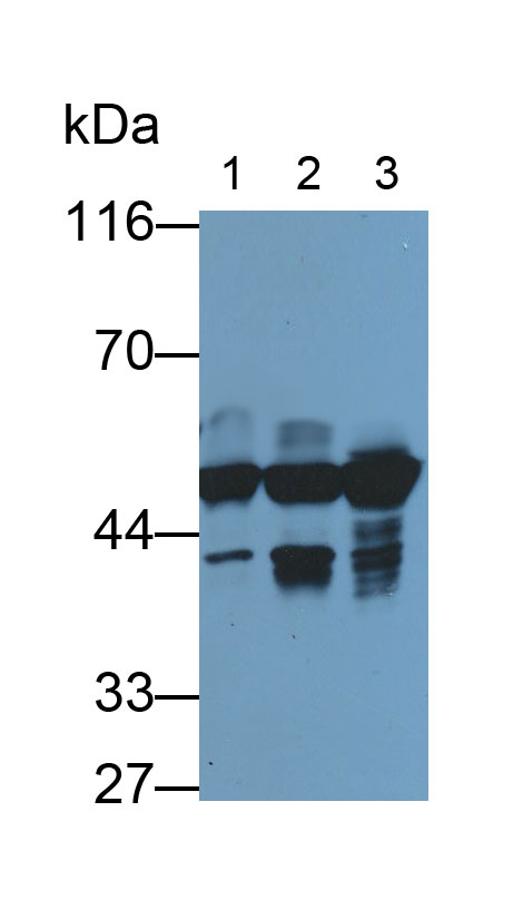 Monoclonal Antibody to Cytokeratin 18 (CK18)